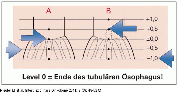 Biopsieprotokoll