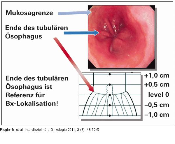 Endoskopie