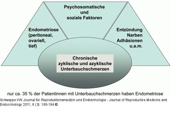 Endometriose