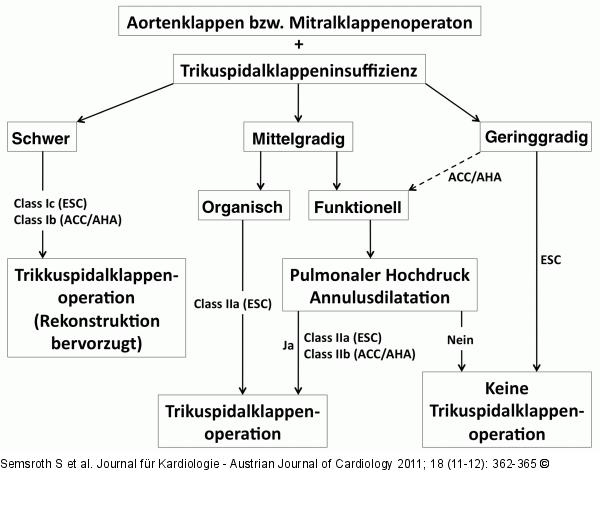 Aortenklappenoperation - Mitralklappenoperation