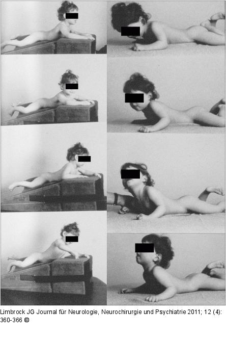 Bauchlage