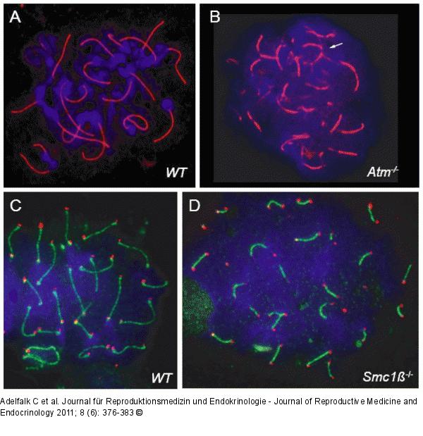 Homologous Chromosomes