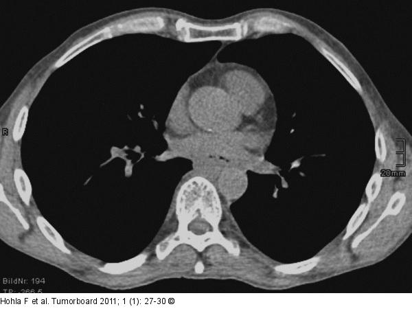 CT-Abdomen