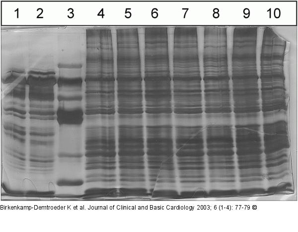 Aquaporinexpression - Proteinexpression