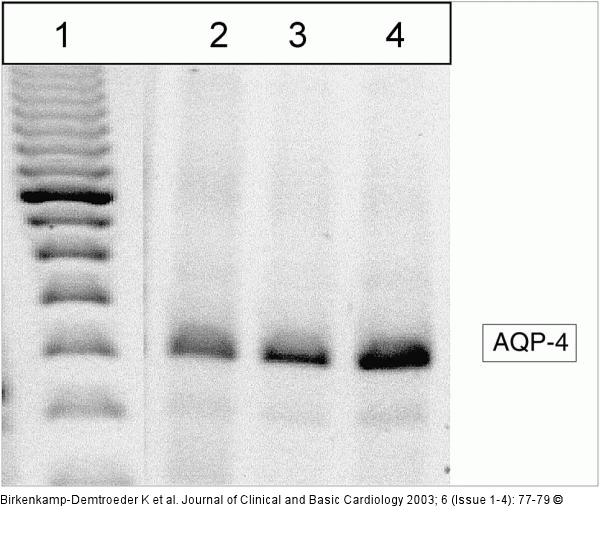 Aquaporinexpression - Proteinexpression