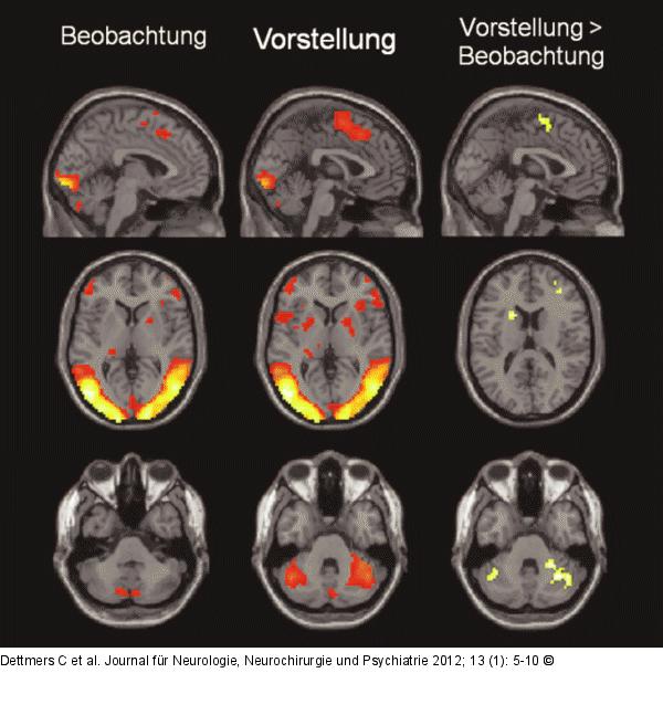 Bewegung - Bewegungsvorstellung