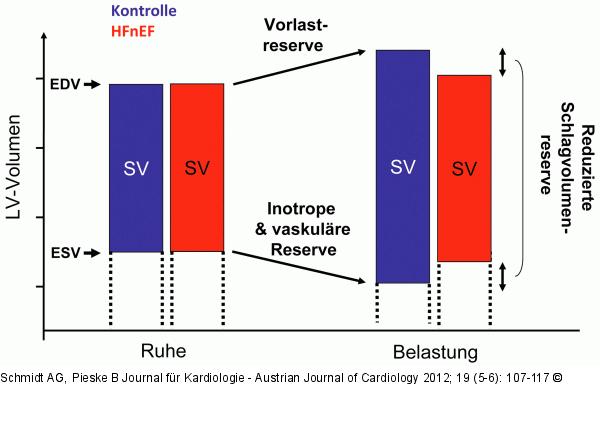 Schlag-Volumen-Reserve