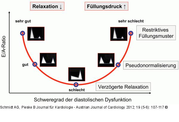 Transmitrales Einstromprofil