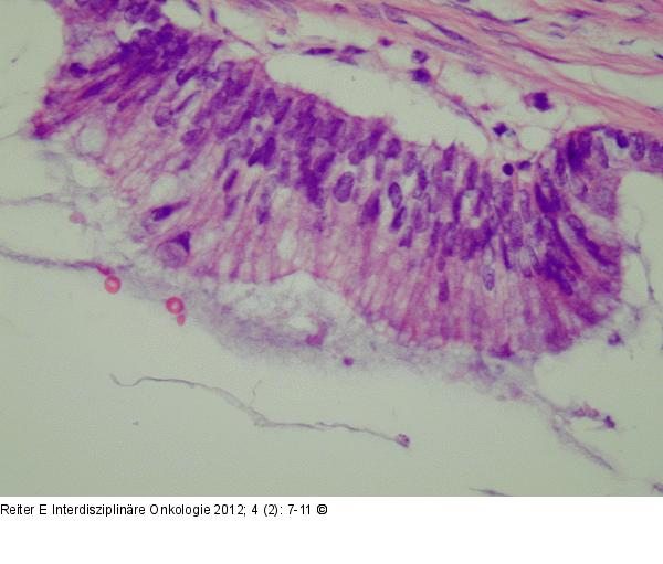 Appendix - Neoplasma