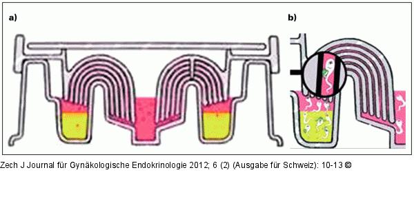Zech-Selector(R)