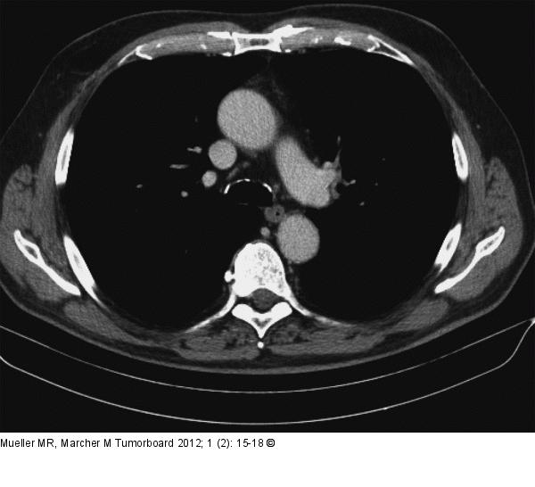 Thorax-CT