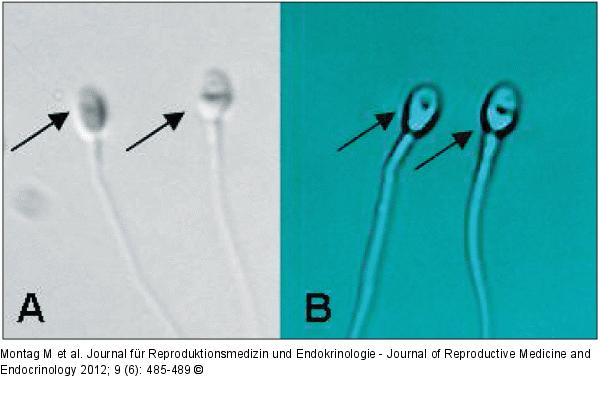 Sperm
