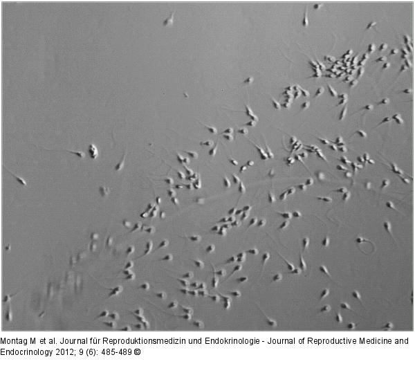 Sperm selection
