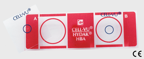 Produkt: HBA und PICSI<br>Vertrieb: Origio GmbH 