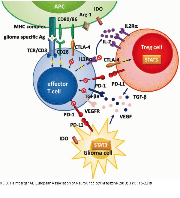 Glioblastoma