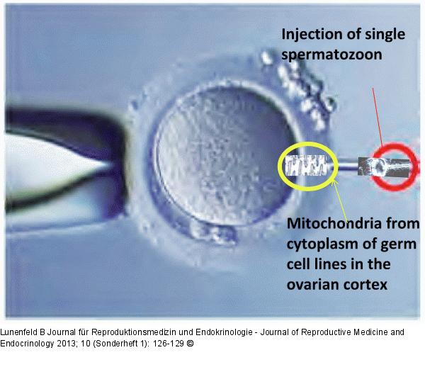Injection of autologous purified mitochondria