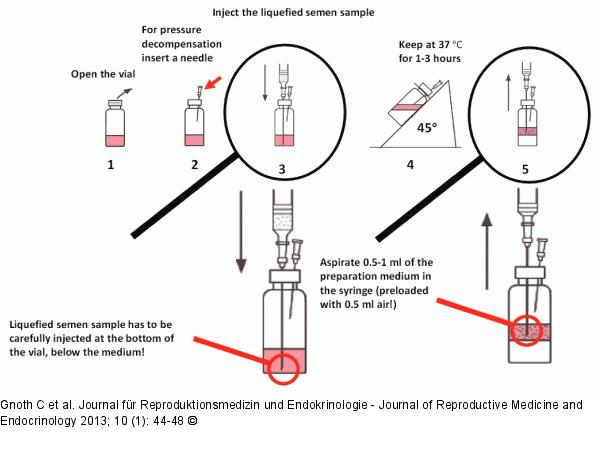 Sperm preparation