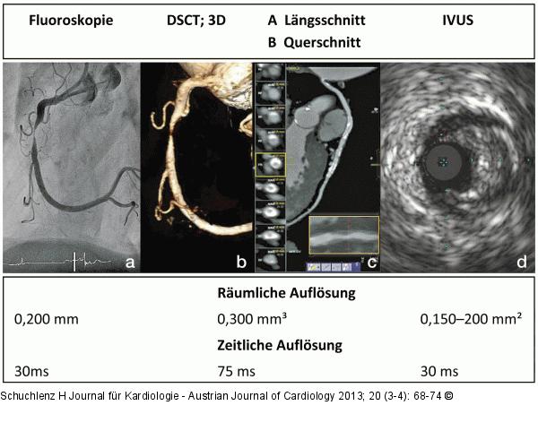 Herz-CT