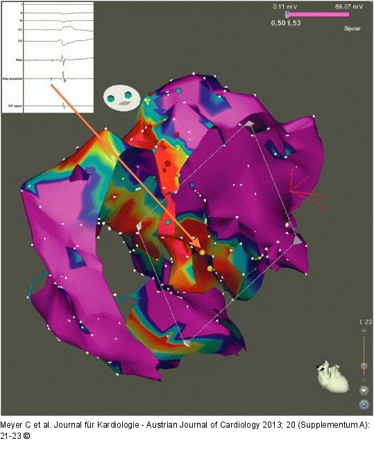 Elektroanatomisches Mapping