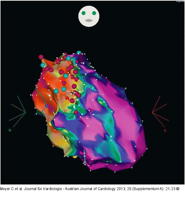 Elektroanatomisches Mapping