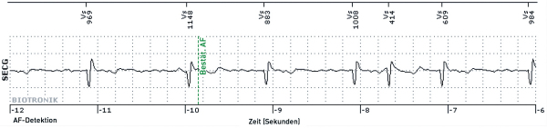 Produkt: BioMonitor <br> Vertrieb: BIOTRONIK Vertriebs-GmbH