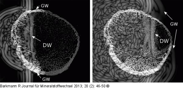Quantitativer Ultraschall