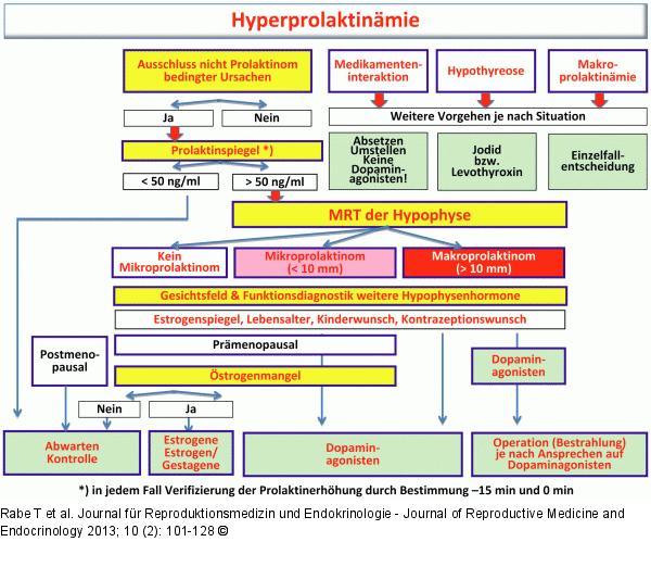 Hyperprolaktinmie - Prolaktinom