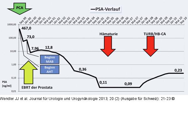 PSA-Verlauf