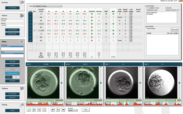 Produkt: EmbryoScope<br>Vertrieb: MTG Medical 