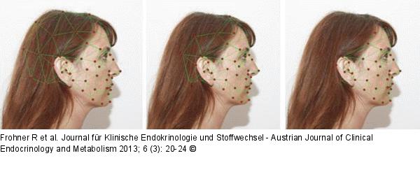 Gesichtsklassifikation