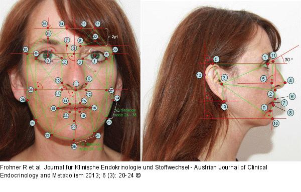 Gesichtsklassifikation