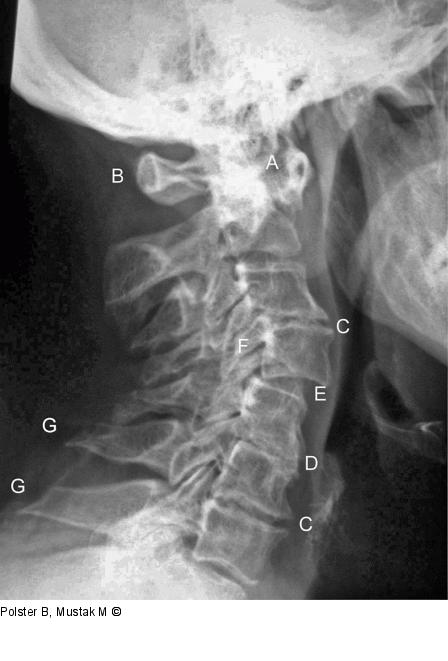 Rheumapatienten im OP