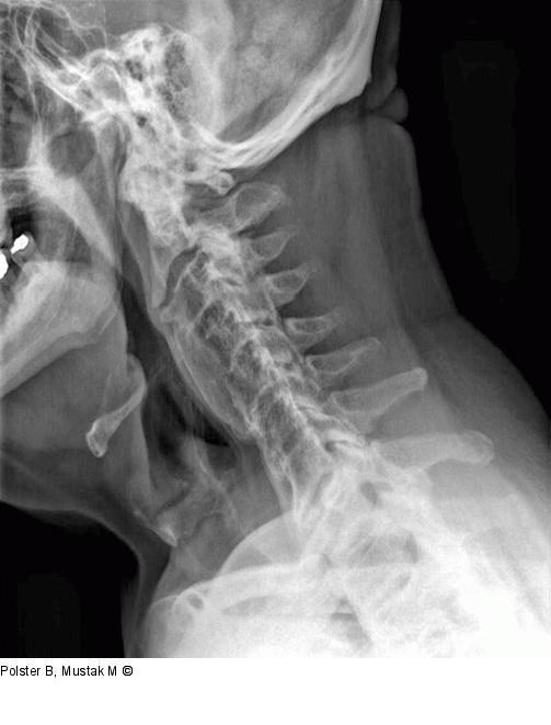 Rheumapatienten im OP