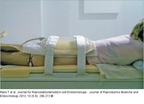 HIFU-Behandlung