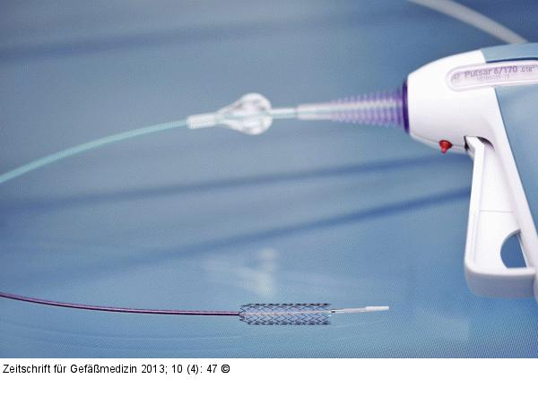 Produkt: BIOTRONIK Pulsar-18-Stent<br>Vertrieb: Biotronik Vertriebs-GmbH
