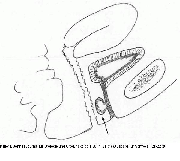 Harnrhre