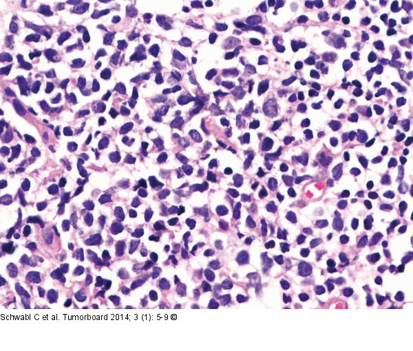 Follikulres Lymphom