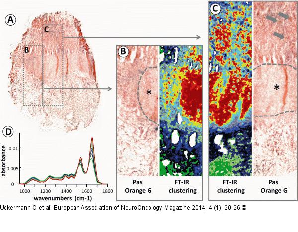 FT-IR imaging