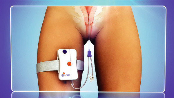 Produkt: EVIE<br>Vertrieb: Kairos Life Sciences GmbH