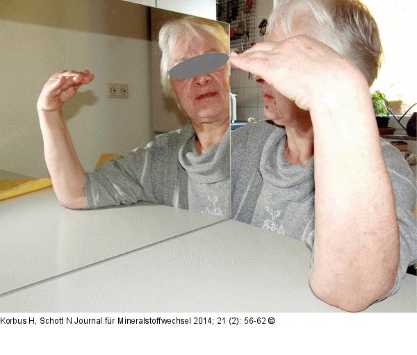Osteoporotische Frakturen