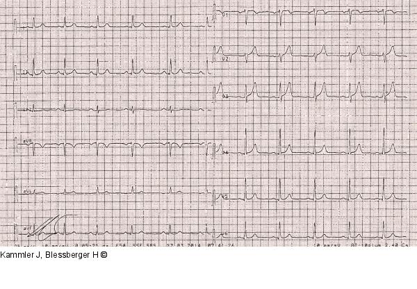 Ruhe-EKG