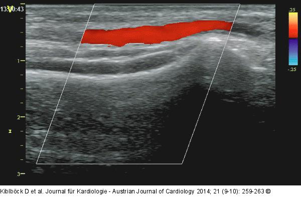 Farbdoppler