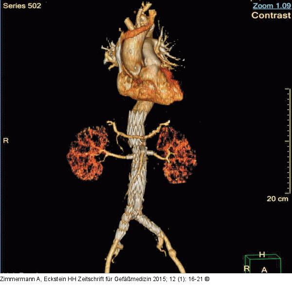 CT-Angiographie