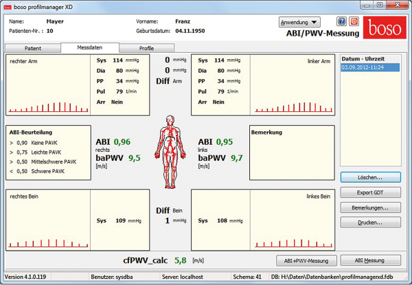 Produkt: boso ABI-system 100<br>Vertrieb: Boso GmbH und Co. KG 