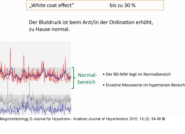White-Coat-Effect