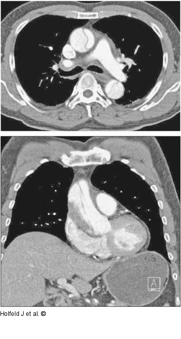 CT-Angiographie