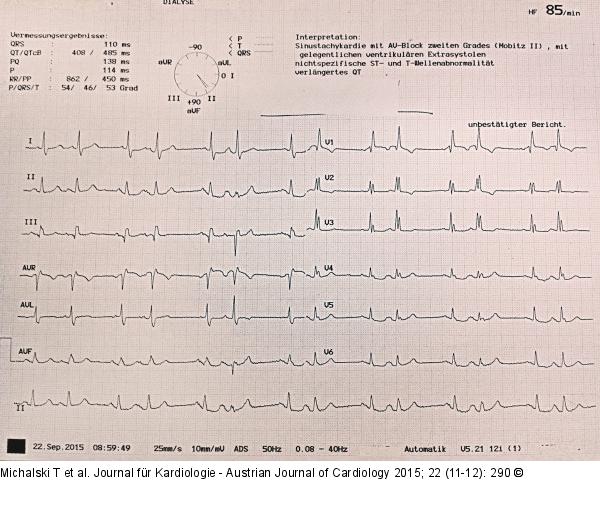 EKG