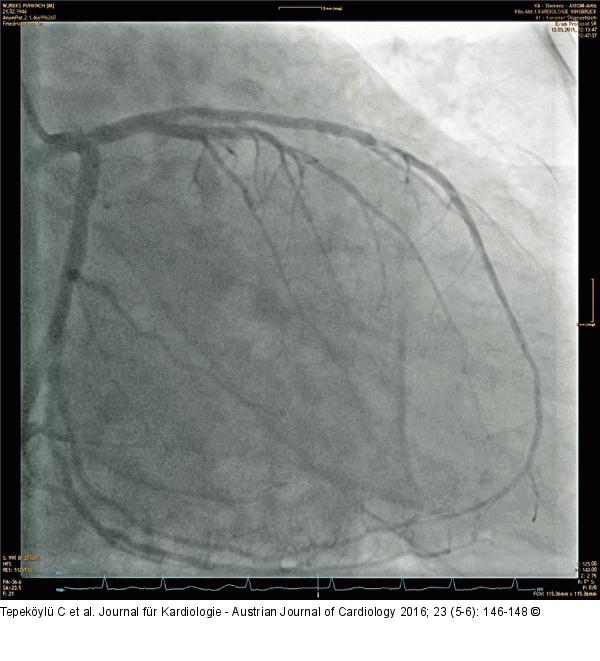 Angiographie