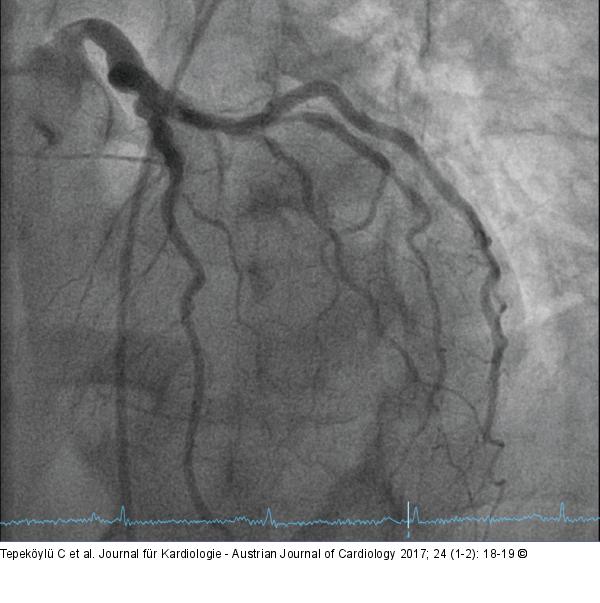 Angiographie
