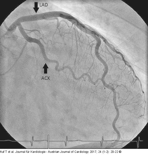 Angiographie